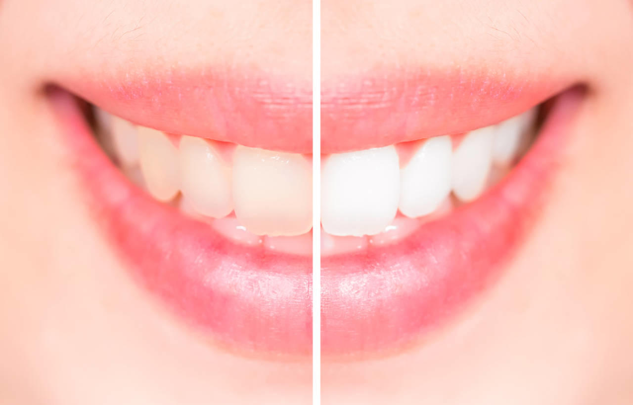 Estetica dentale Estetica dentale