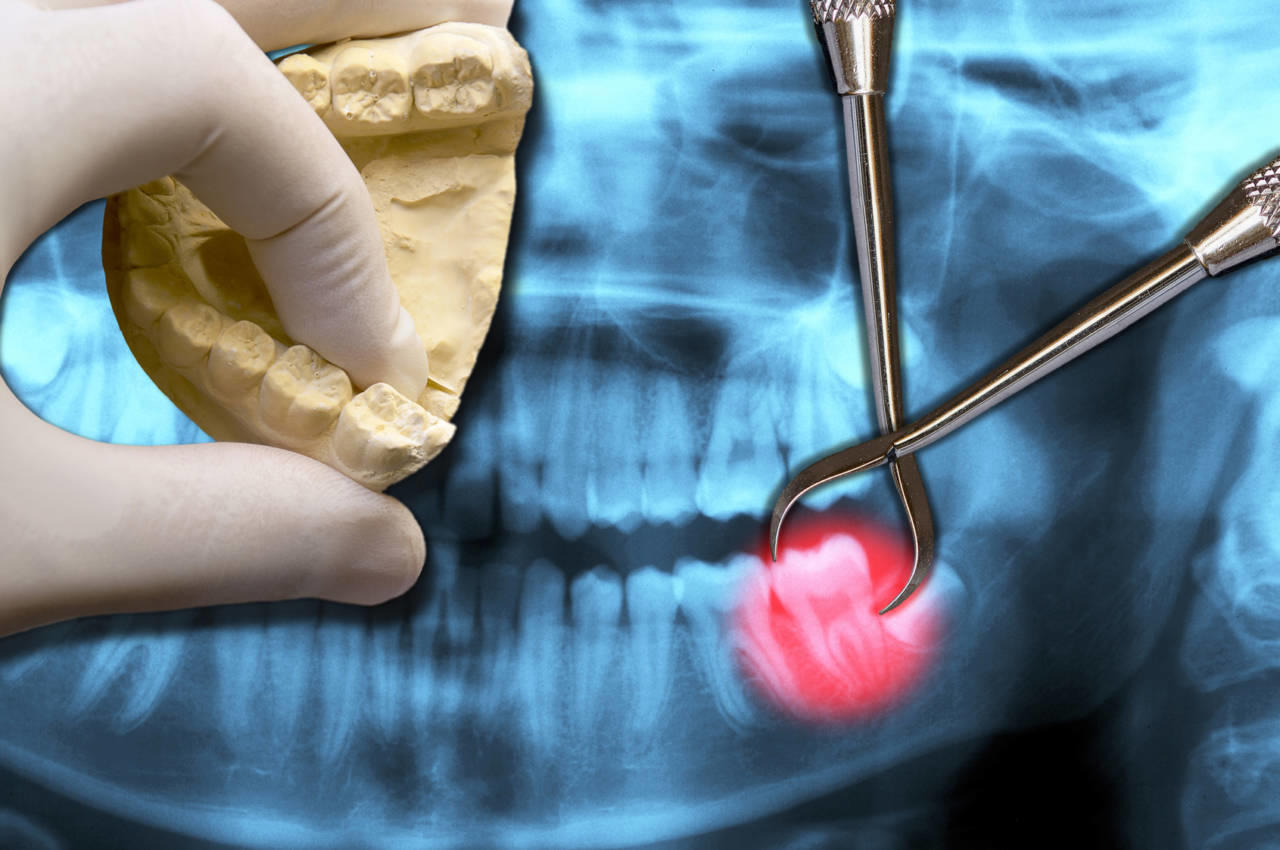 Radiologia Odontoiatrica