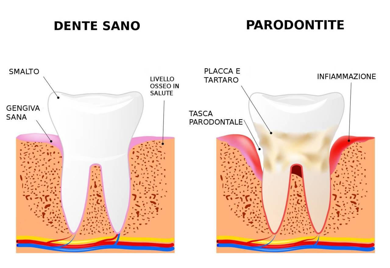 Chirurgia Paradontale