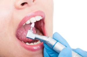 Seduta di igiene dentale 11