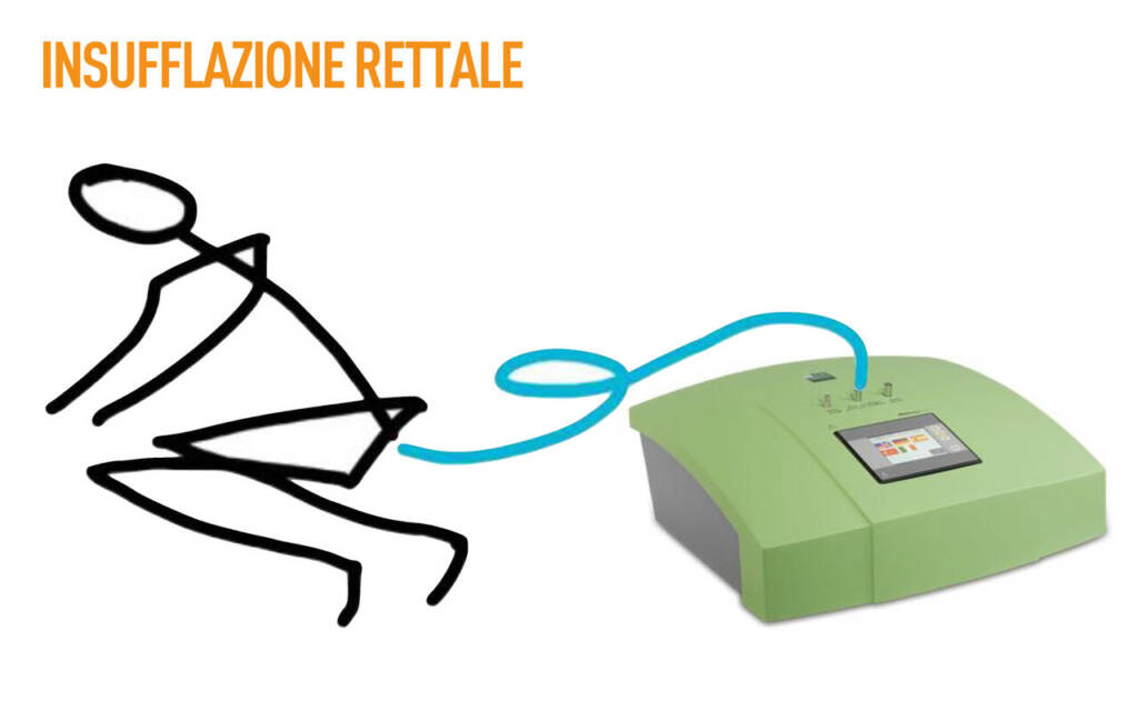 Come si pratica l’ossigenoozonoterapia? Sangiovanni Come si pratica l’ossigenoozonoterapia? Sangiovanni
