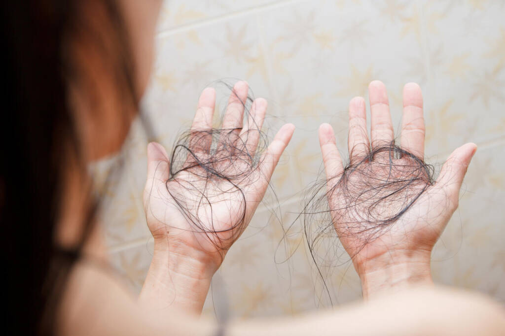 Hair,Falling,Out,In,Two,Hands,After,Rinse,Off,Shampoo.